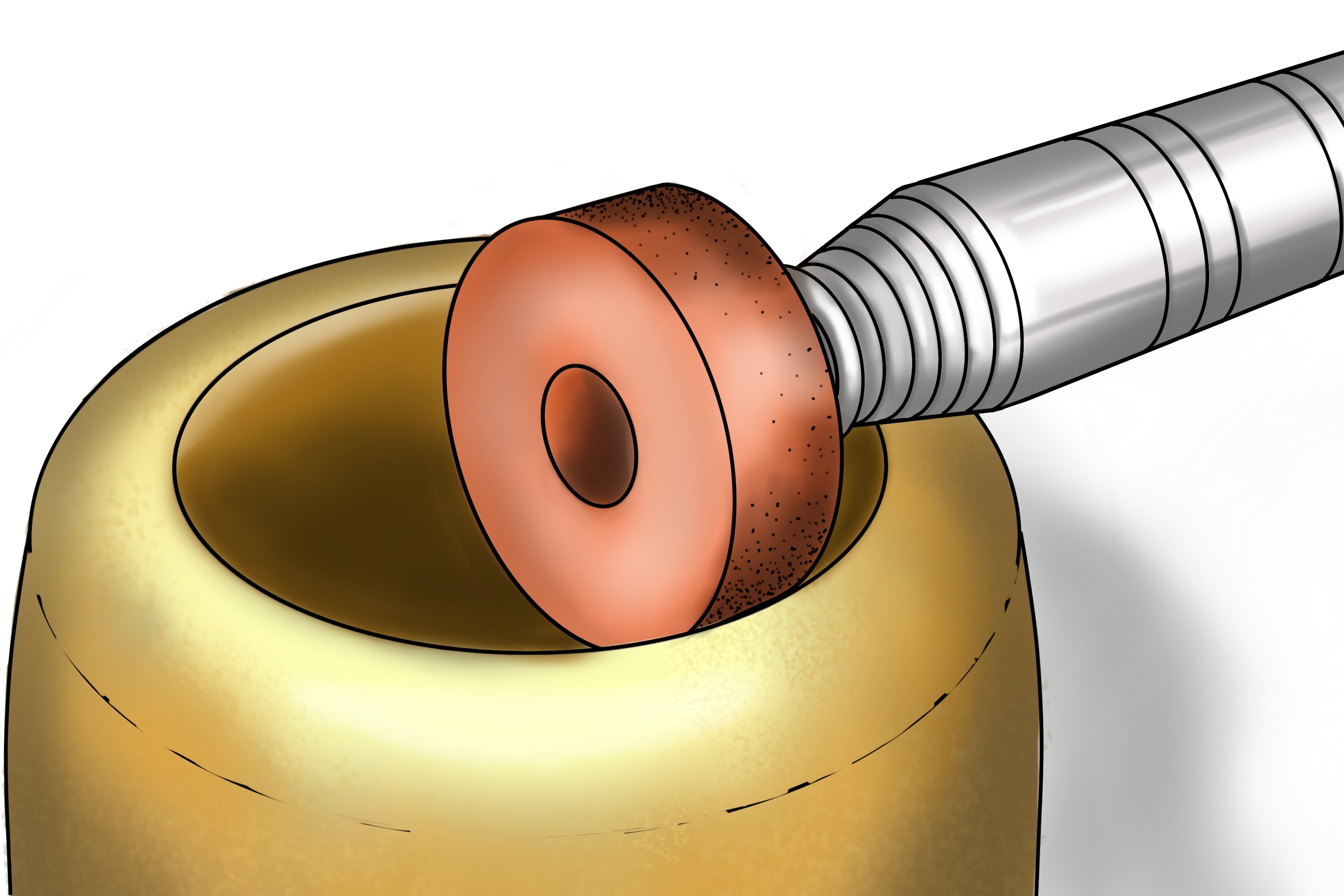 Working on a radius 